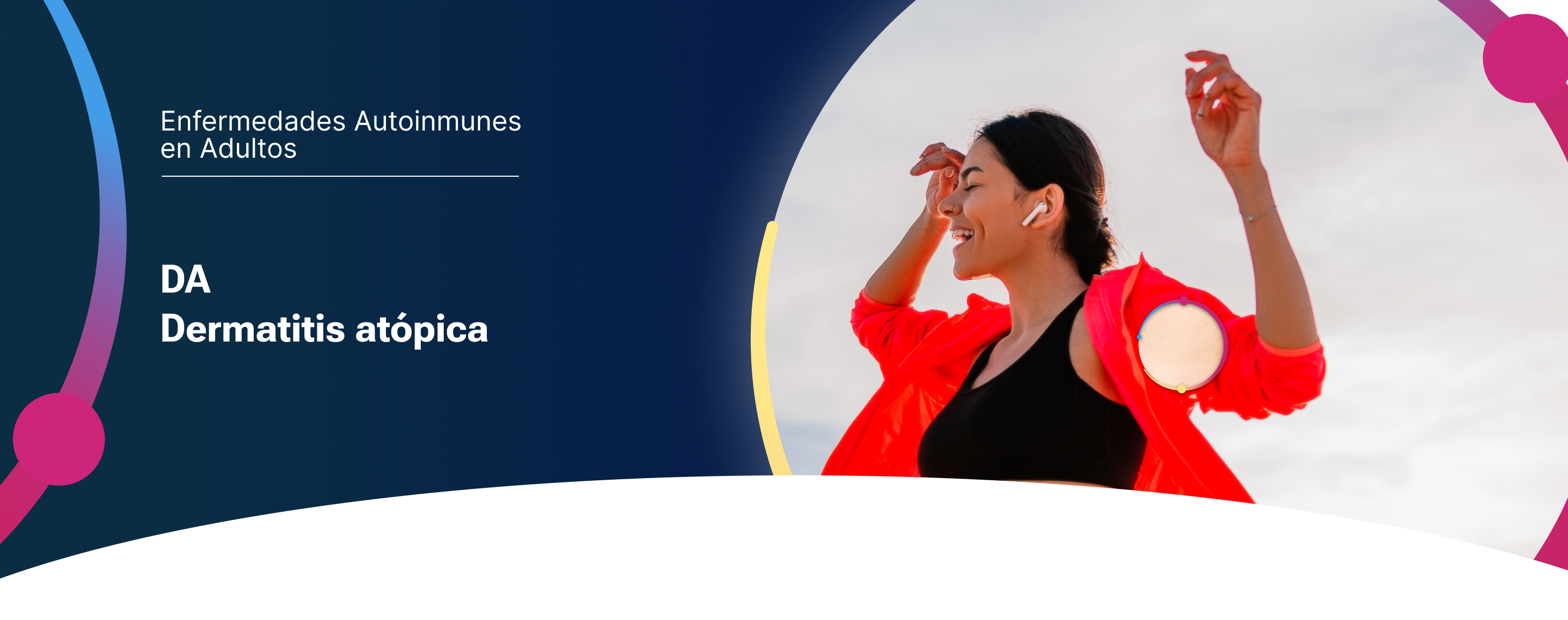 Banner dermatitis atopica